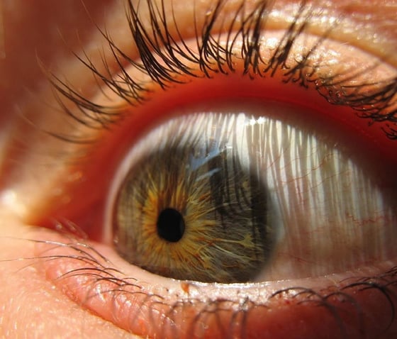 eyeads